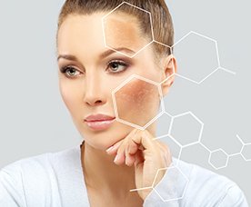 Πανάδες - Κηλίδες